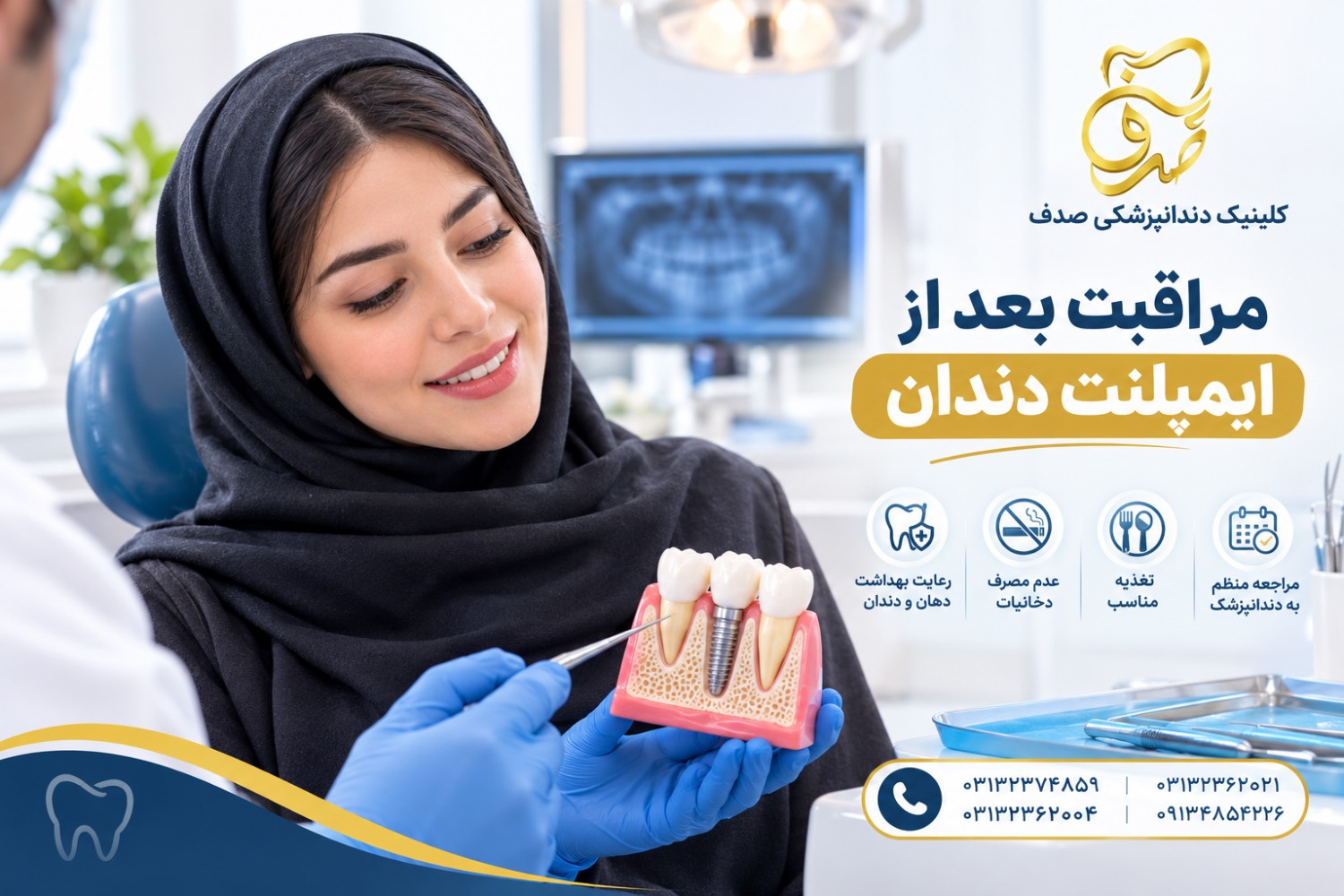مراقبت بعد از ایمپلنت دندان