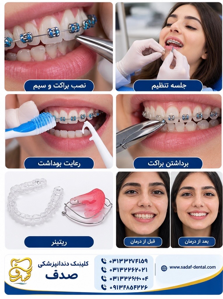 مراحل ارتودنسی دندان