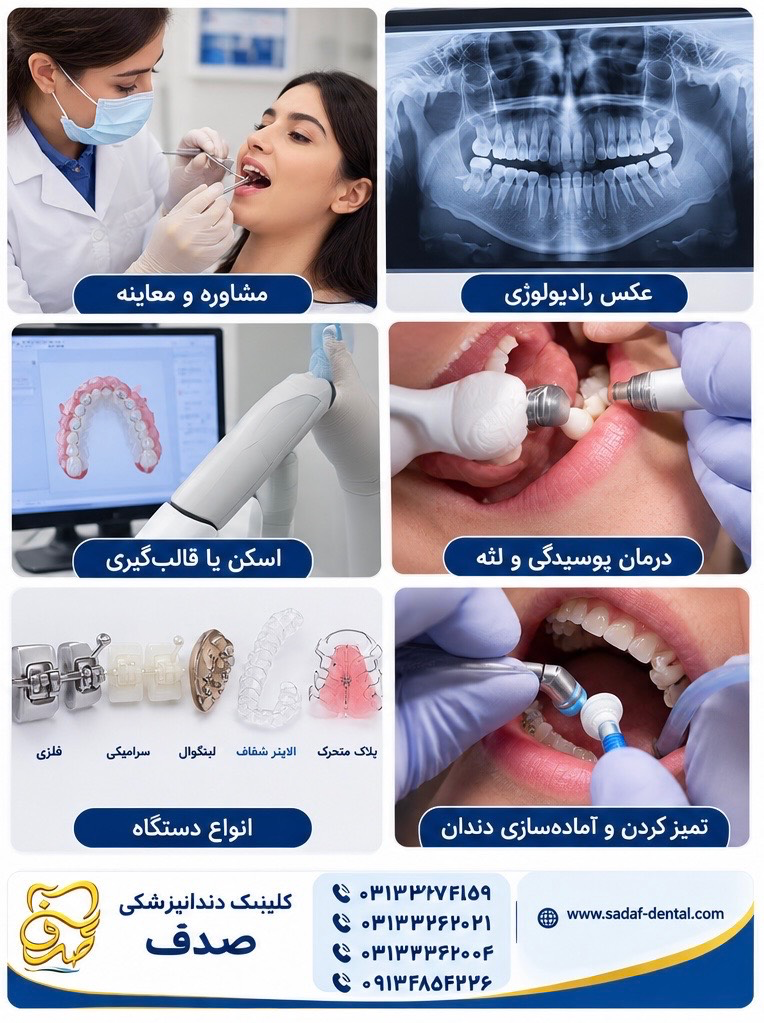 مراحل ارتودنسی دندان