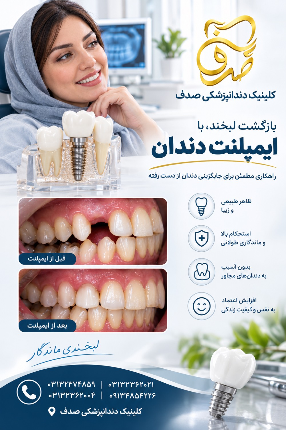 مهم‌ترین نکته‌های مراقبت بعد از ایمپلنت