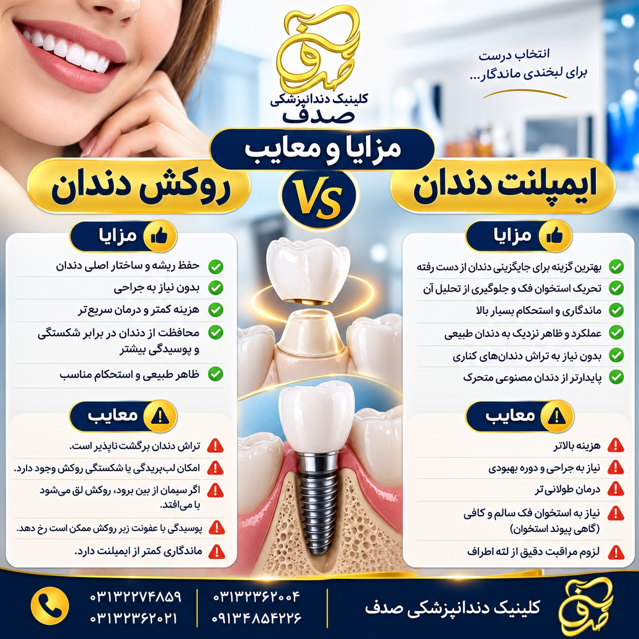 مزایا و معایب روکش دندان و ایمپلنت