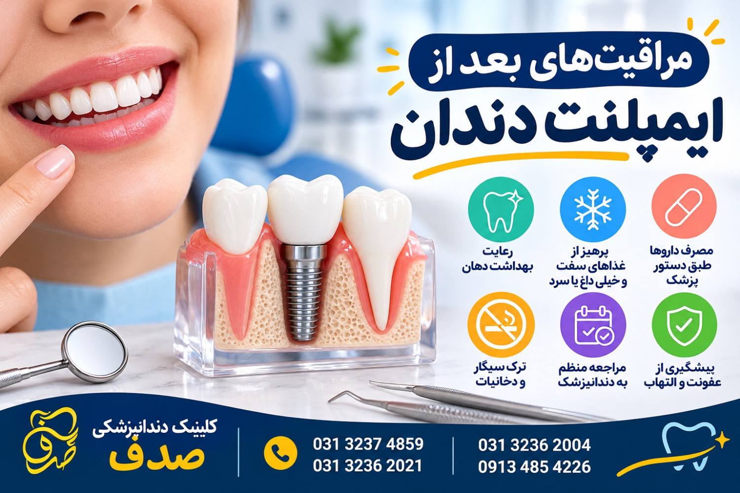 مراقبت بعد از ایمپلنت دندان
