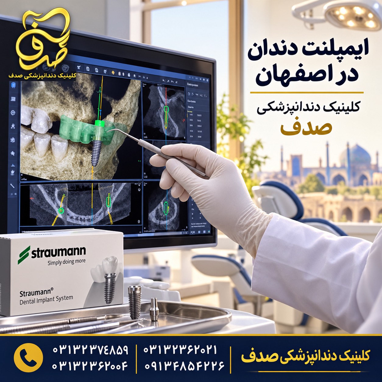 ایمپلنت دندان اصفهان