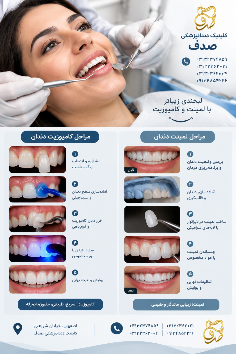 تفاوت کامپوزیت و لمینت دندان