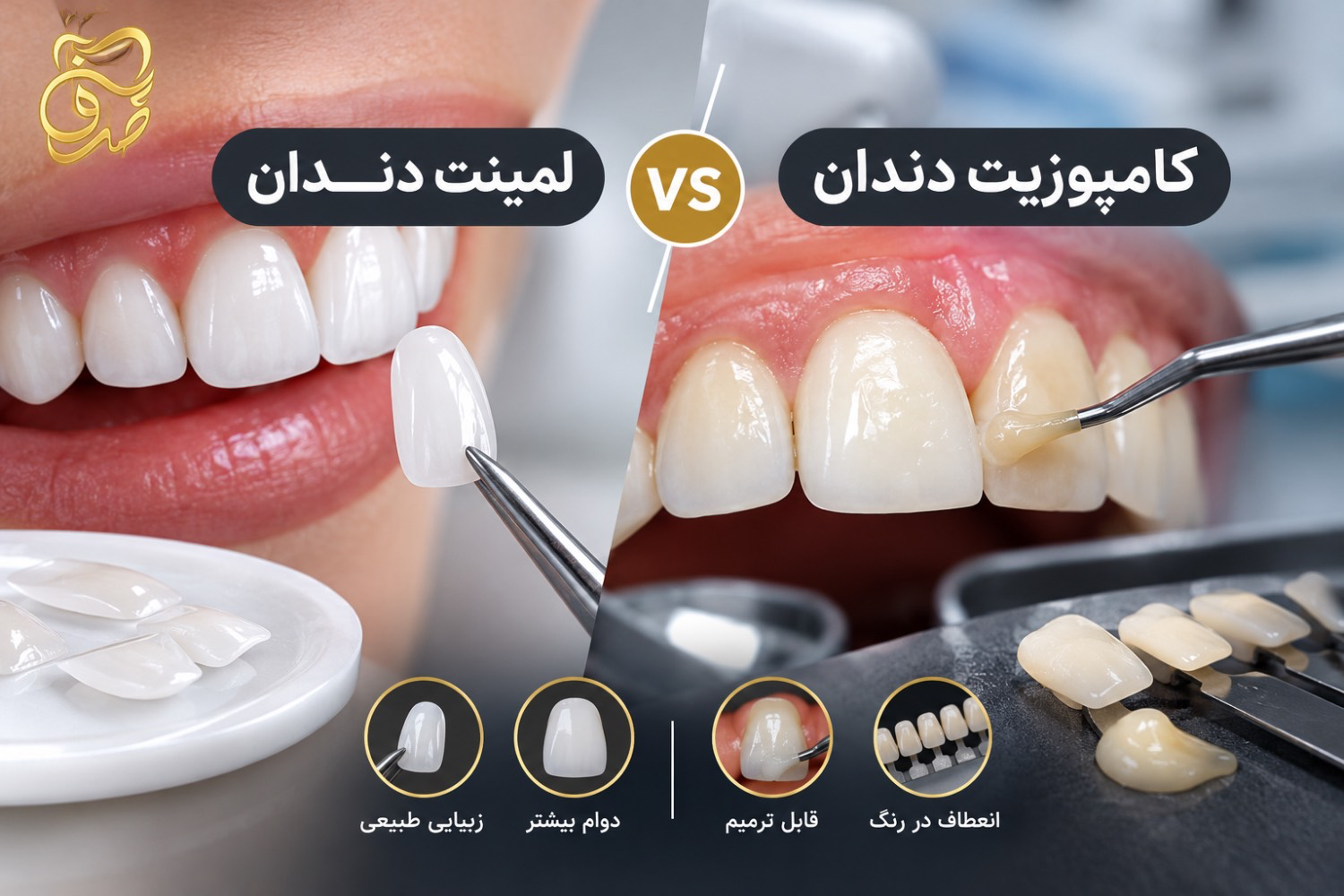 تفاوت کامپوزیت و لمینت دندان